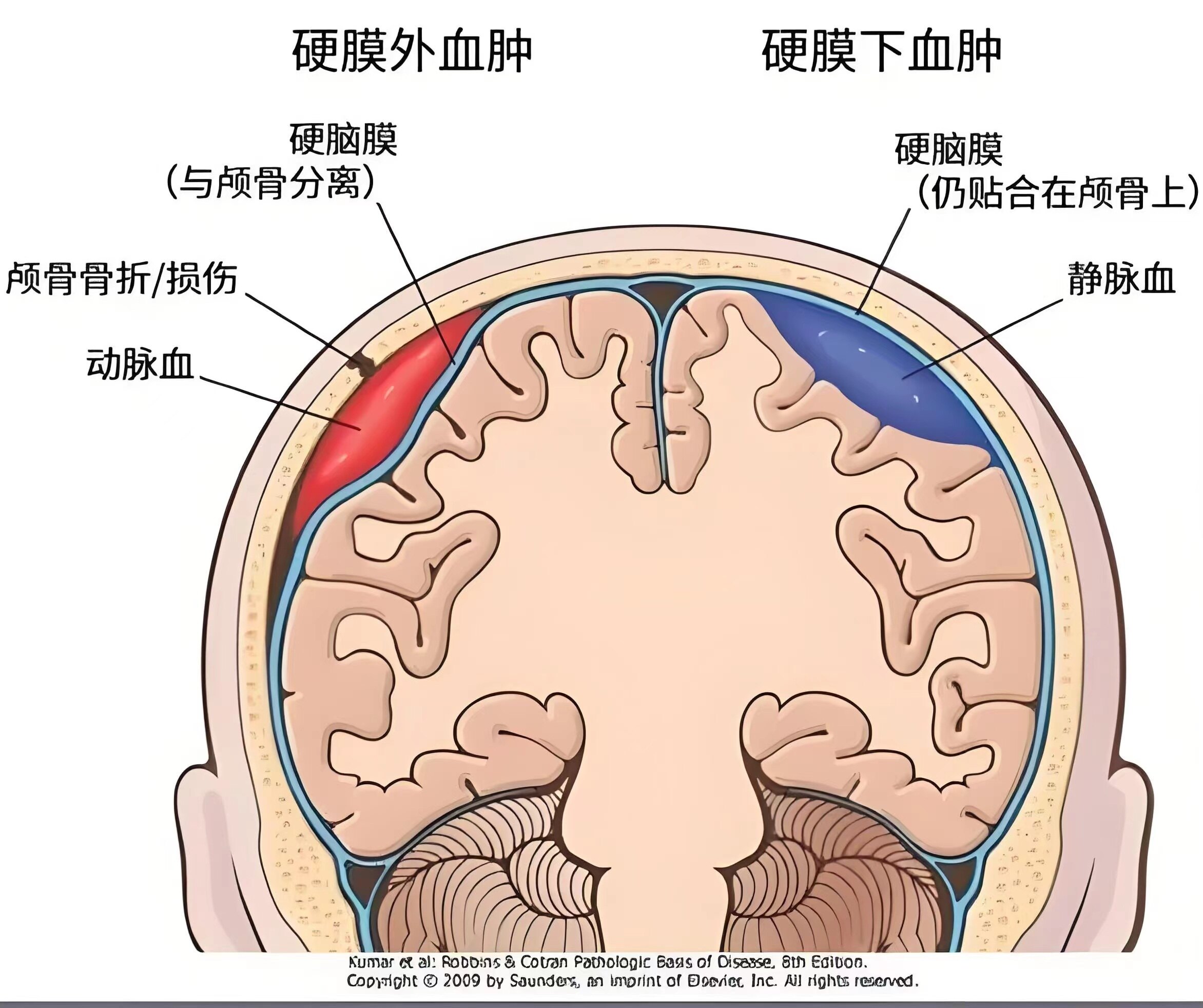 圖文圖片