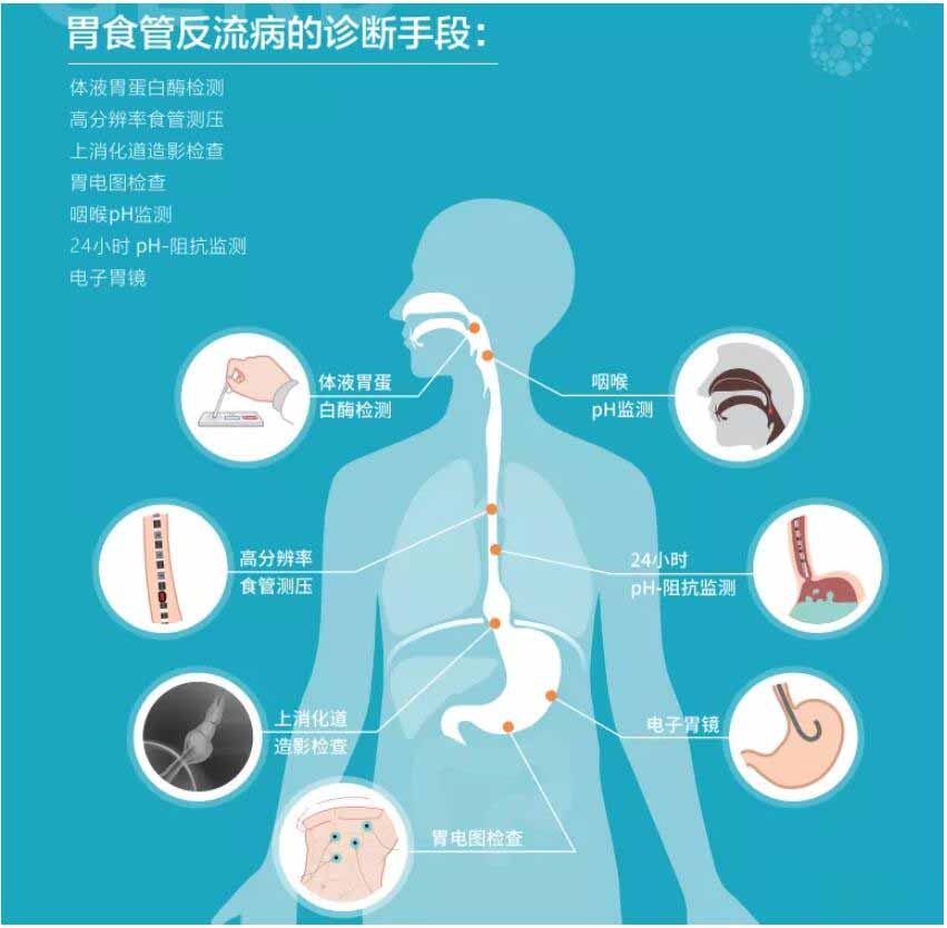 懷疑自己得了胃食管反流病找醫生看病前準備好這3點