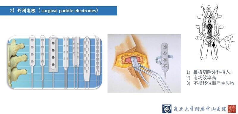 外科电极2.jpg