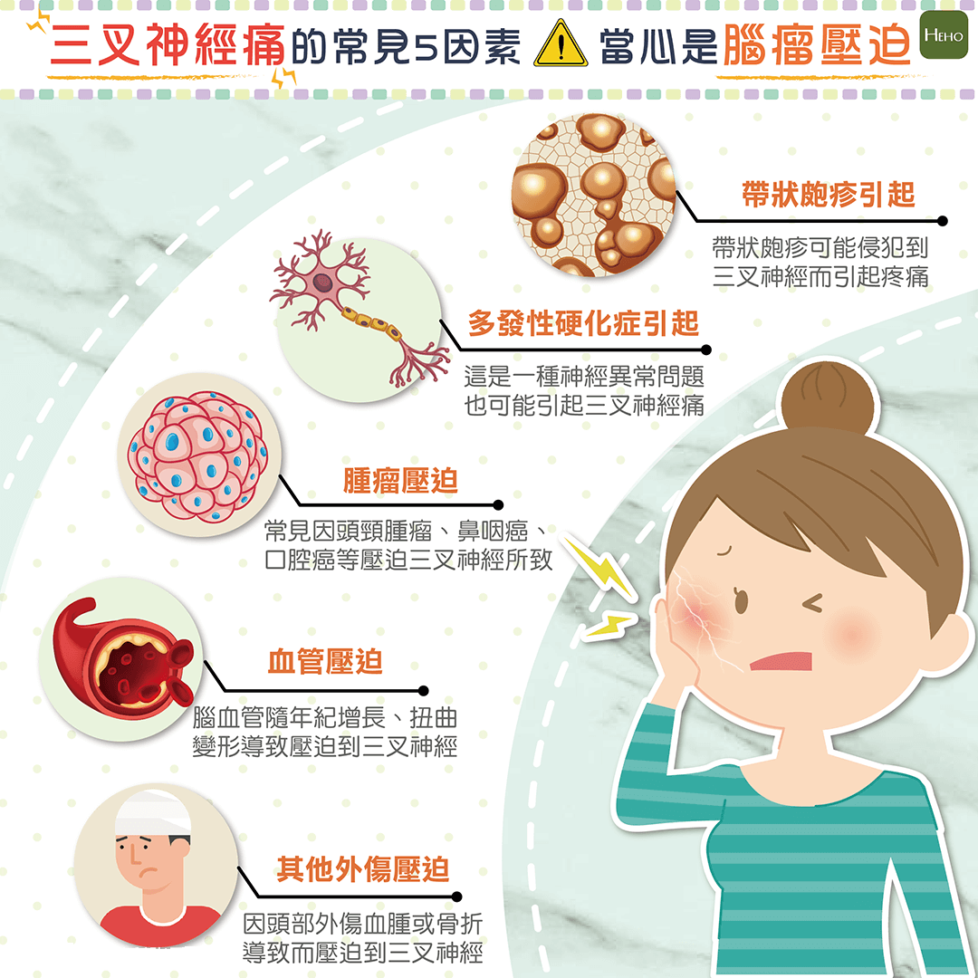 三叉神经痛 - 好大夫在线