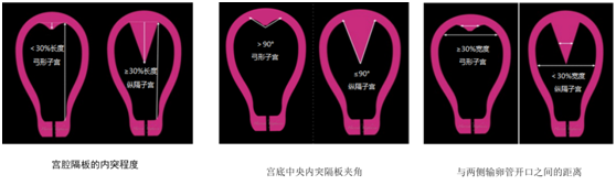 Alipay