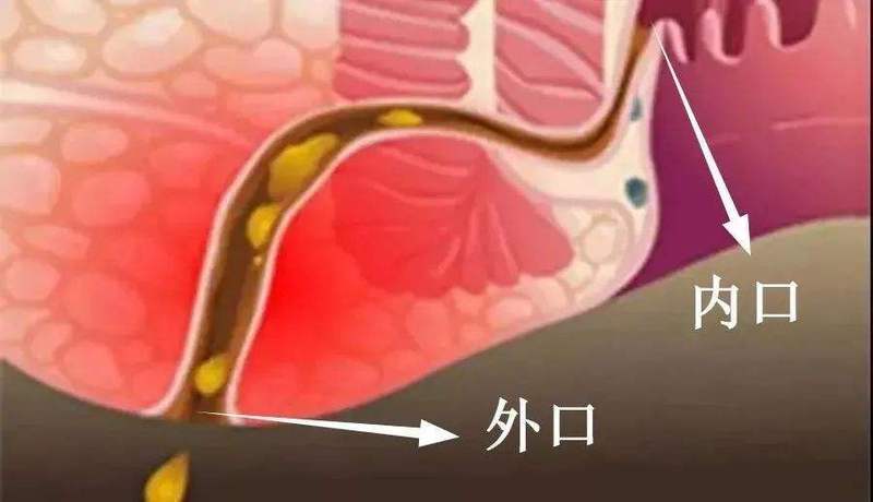 圖文圖片