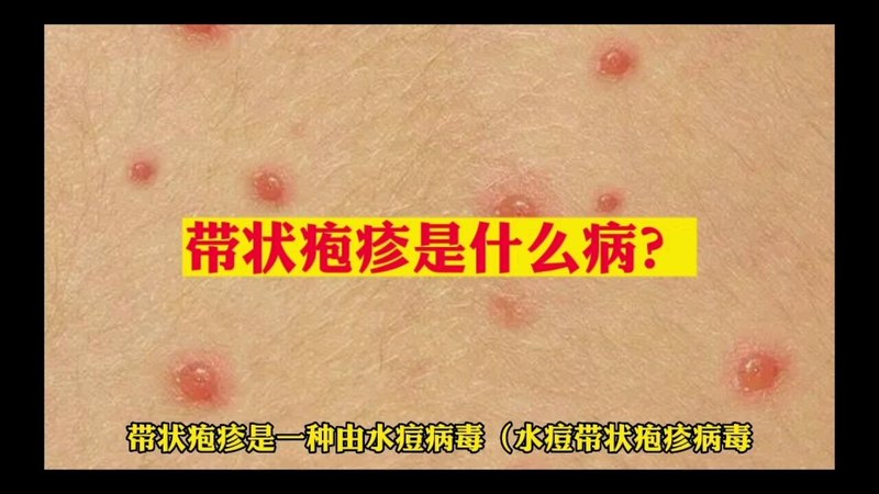 視頻封面