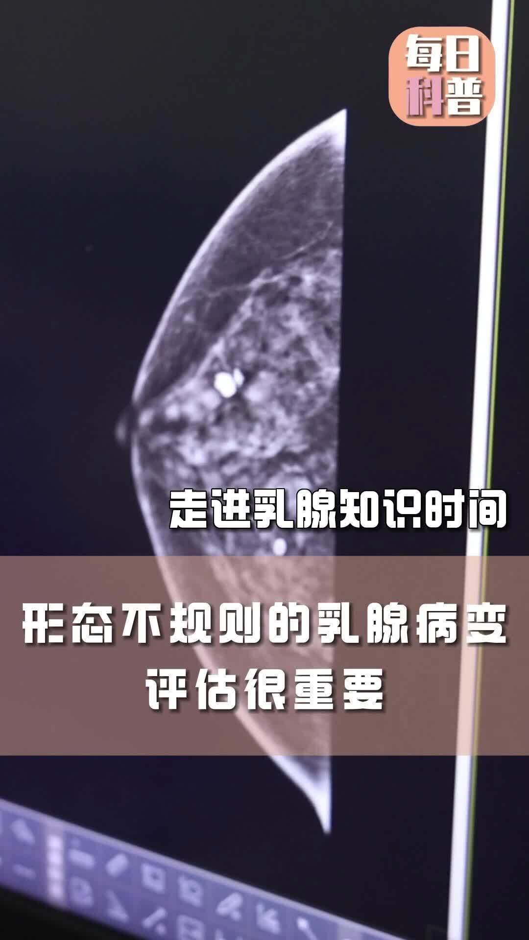 視頻封面