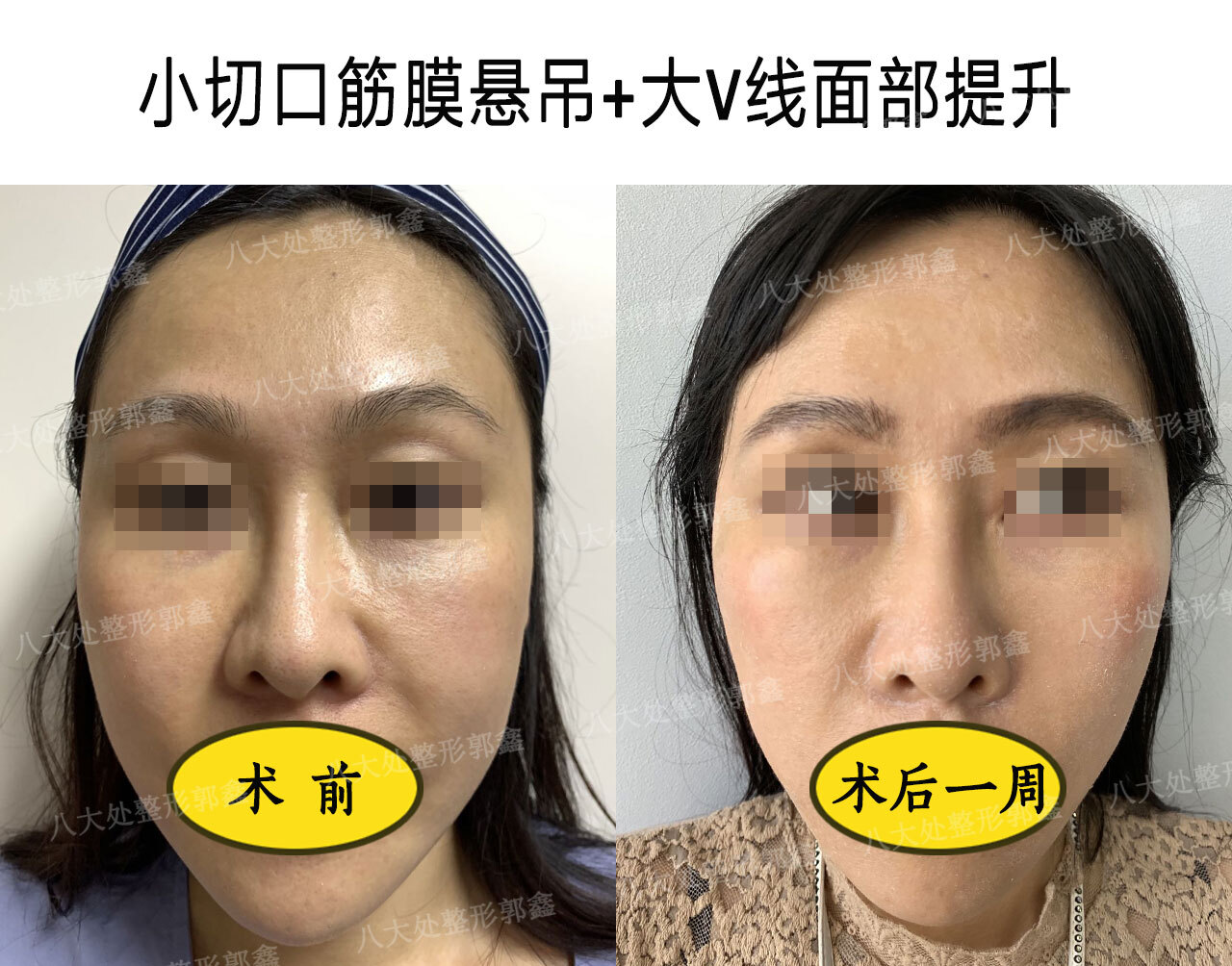 圖文圖片