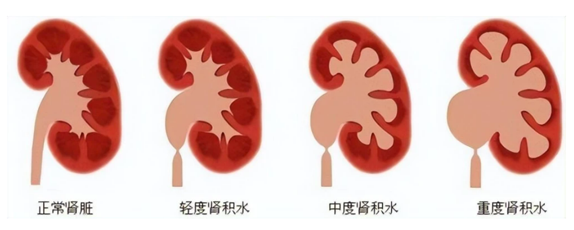 圖文圖片