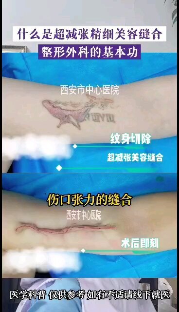 視頻封面