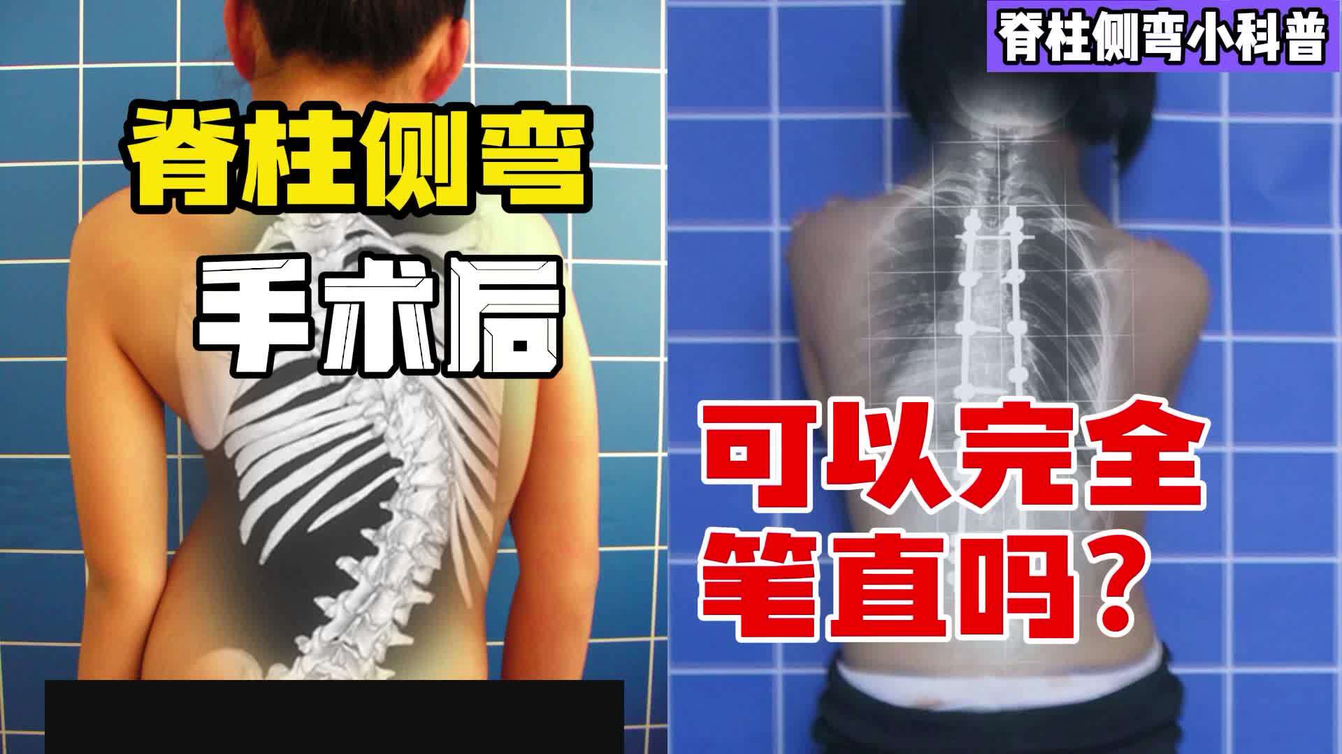 視頻封面