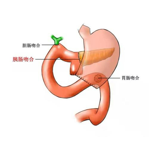 圖文圖片