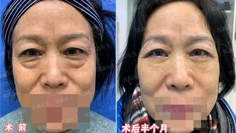 視頻封面