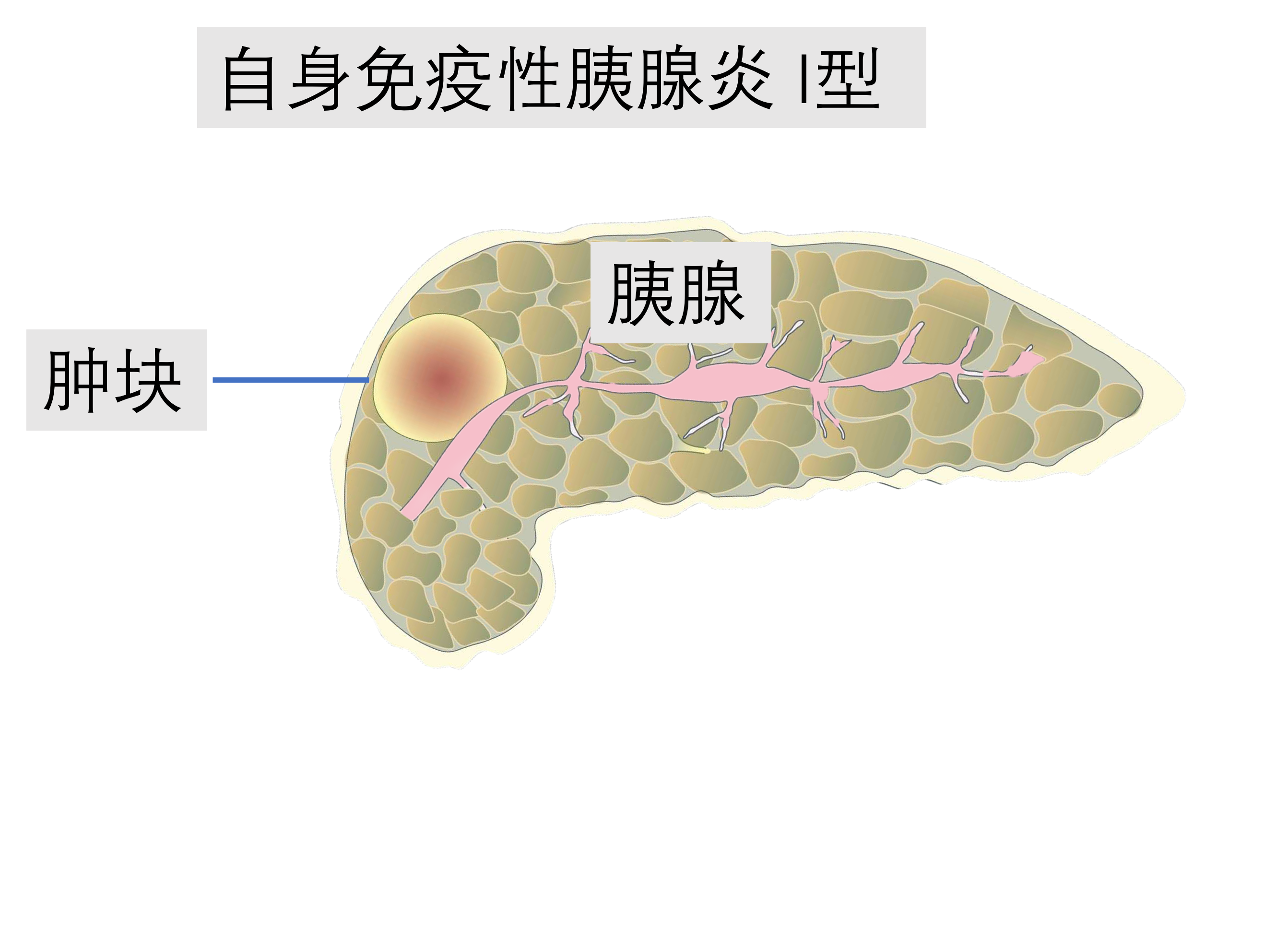 圖文圖片