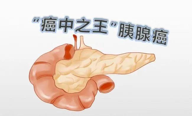 圖文圖片