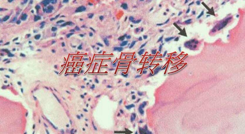 圖文圖片