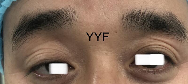 圖文圖片