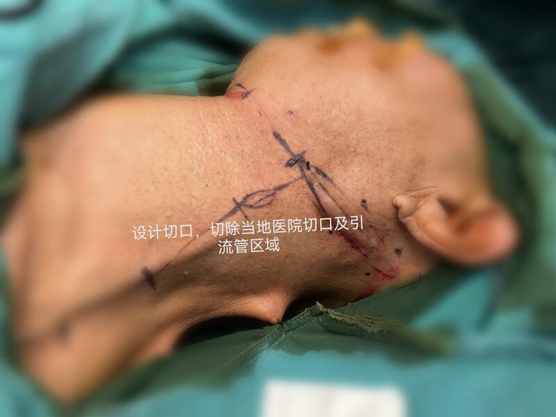 圖文圖片