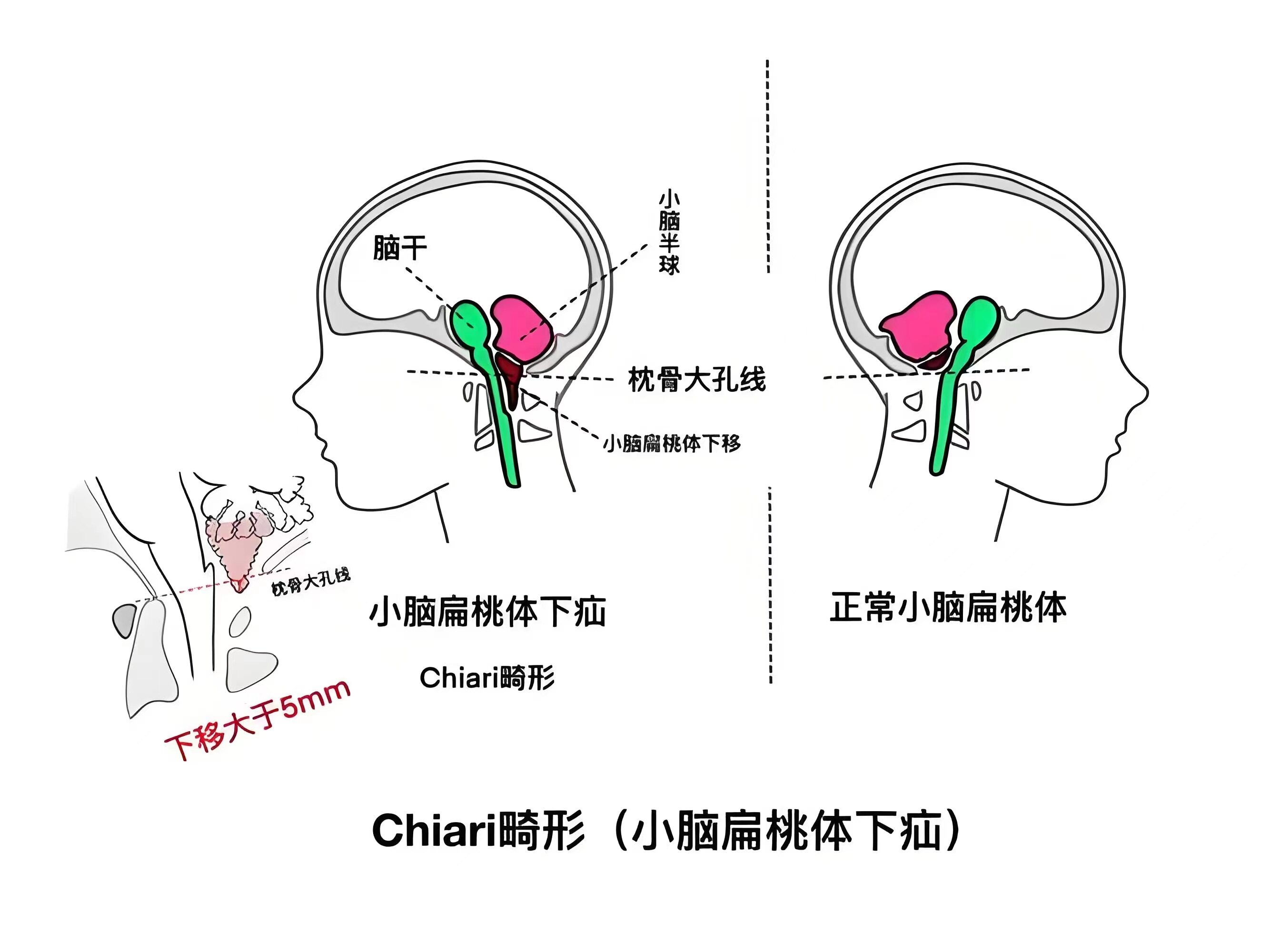 圖文圖片