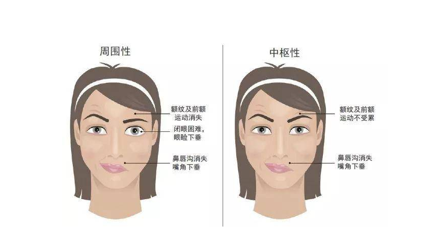 圖文圖片