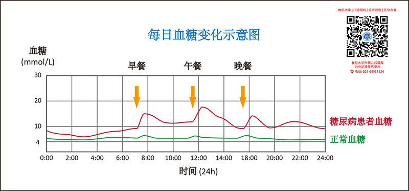 01_每日血糖变化示意图.jpg