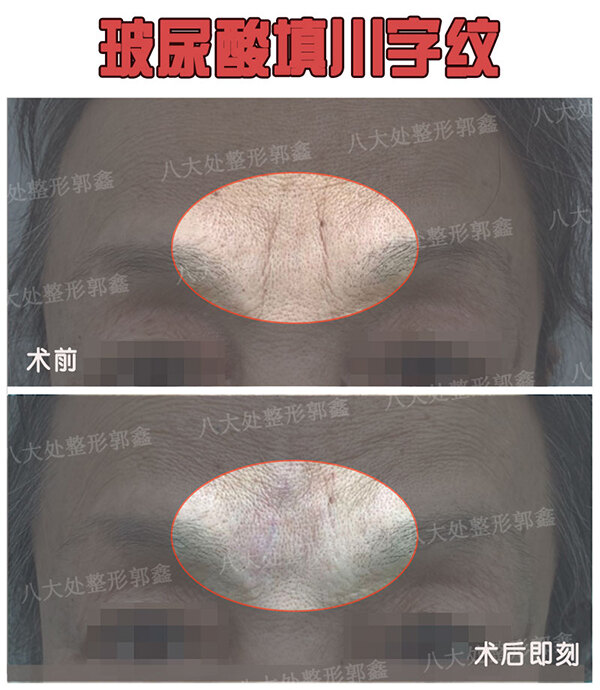 圖文圖片