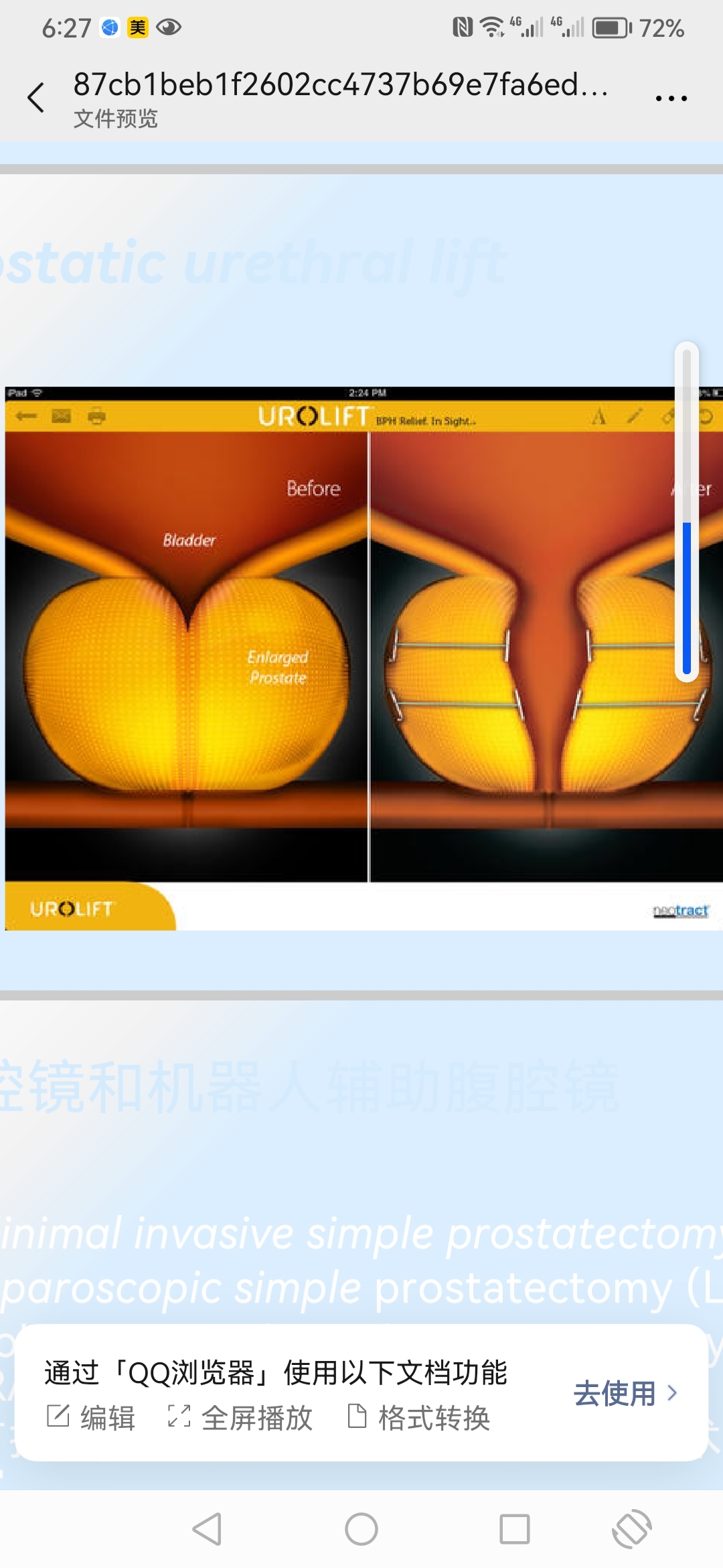 圖文圖片