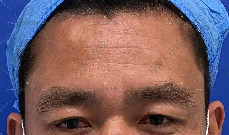 圖文圖片