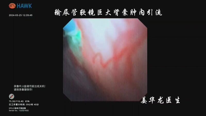 視頻封面
