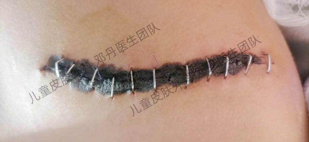 圖文圖片