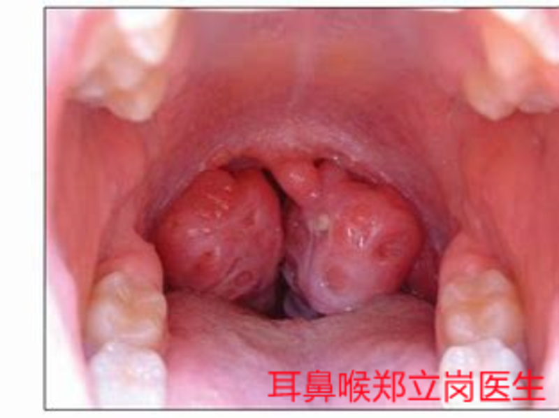 圖文圖片