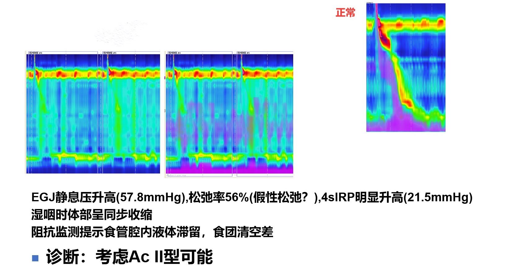 RE病例1-3.jpg