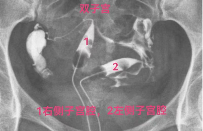医生也傻傻分不清的子宫畸形_子宫畸形_子宫畸形介绍 - 好大夫在线