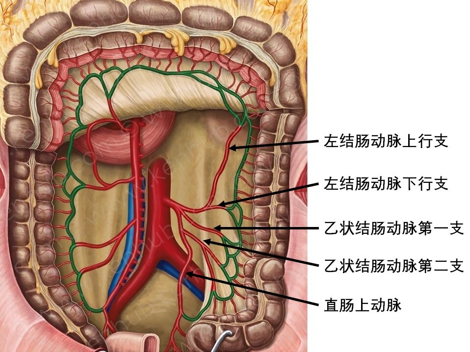 乙状结肠癌手术步骤图图片