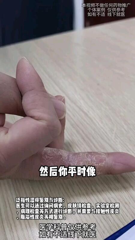 視頻封面