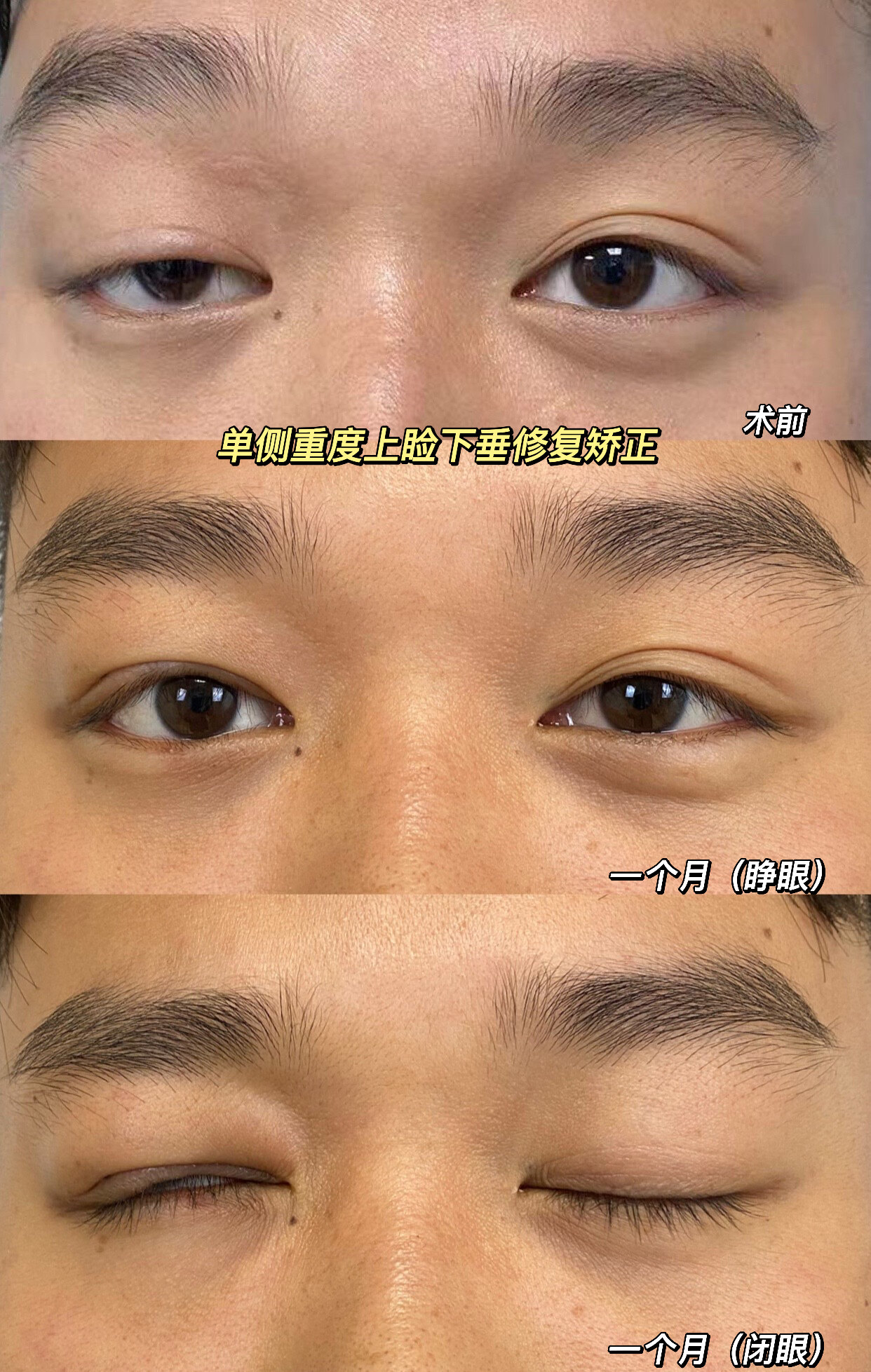 圖文圖片
