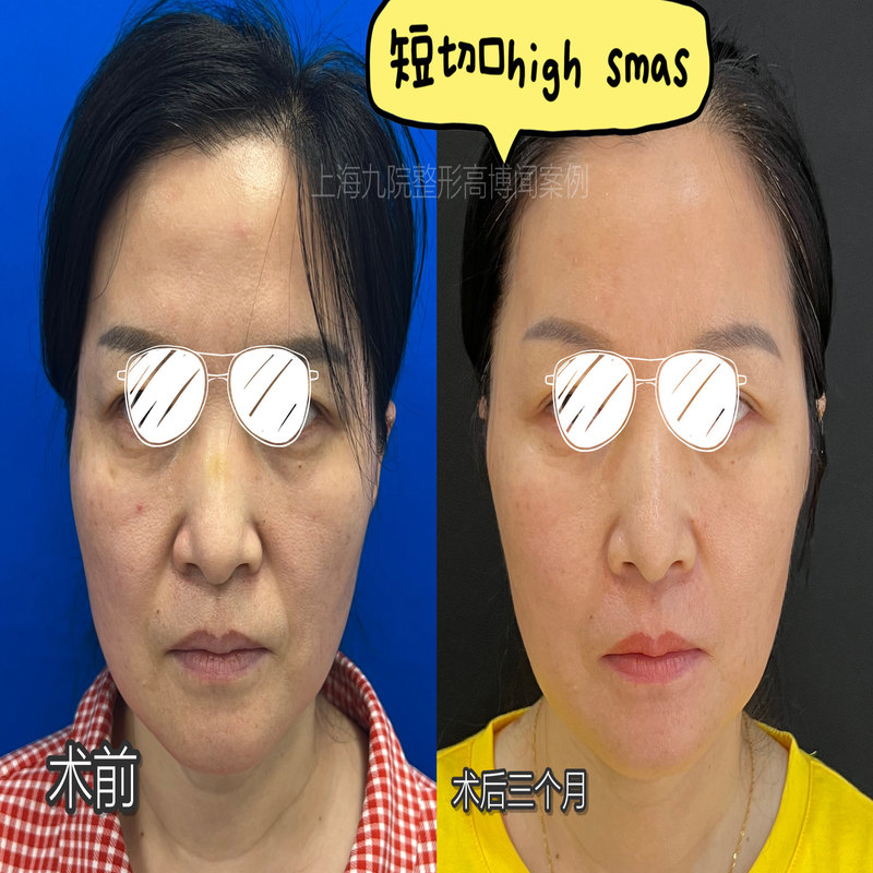 圖文圖片