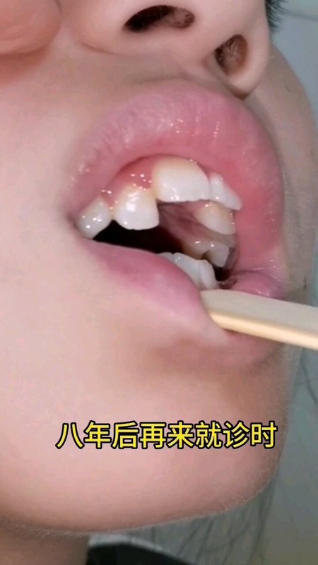 視頻封面