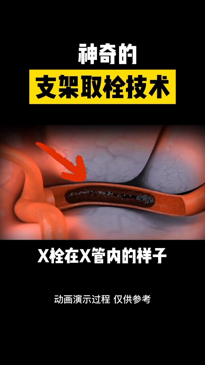 默认图片