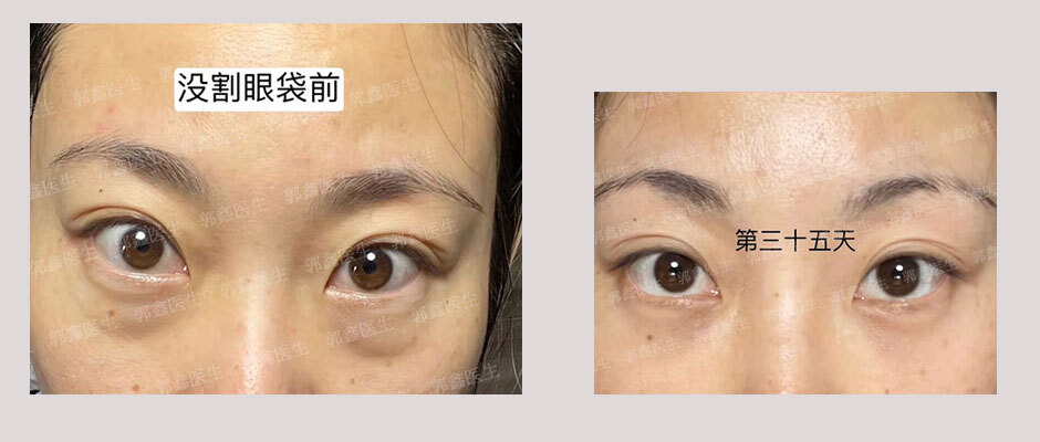 圖文圖片