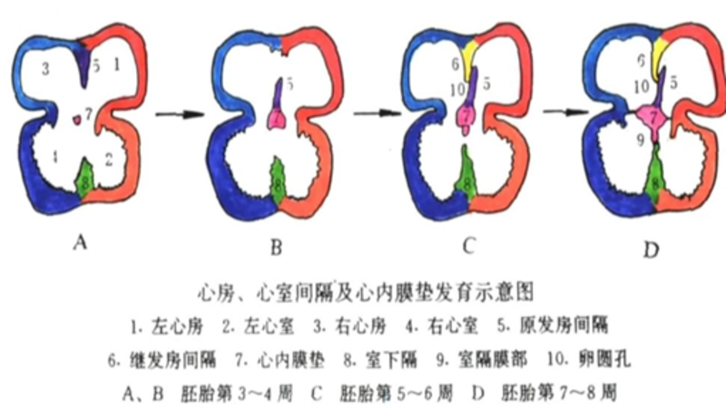 三尖瓣闭锁不全-1.jpg