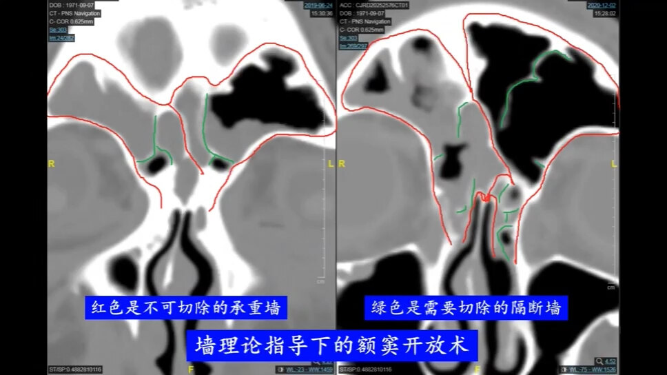 默认图片