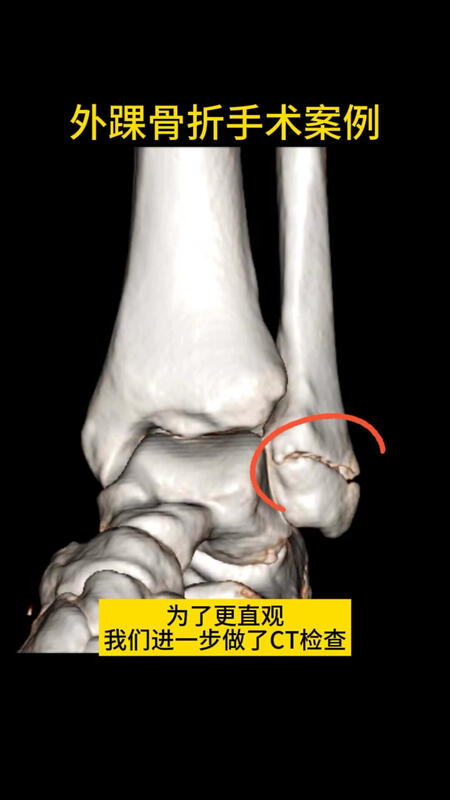 視頻封面