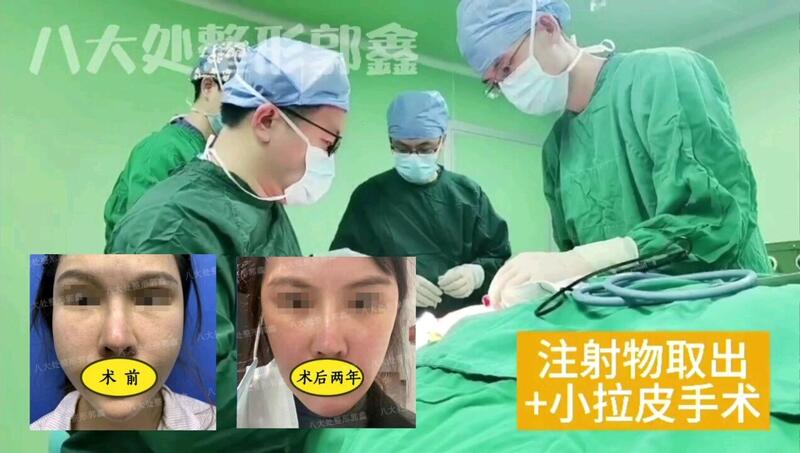 視頻封面