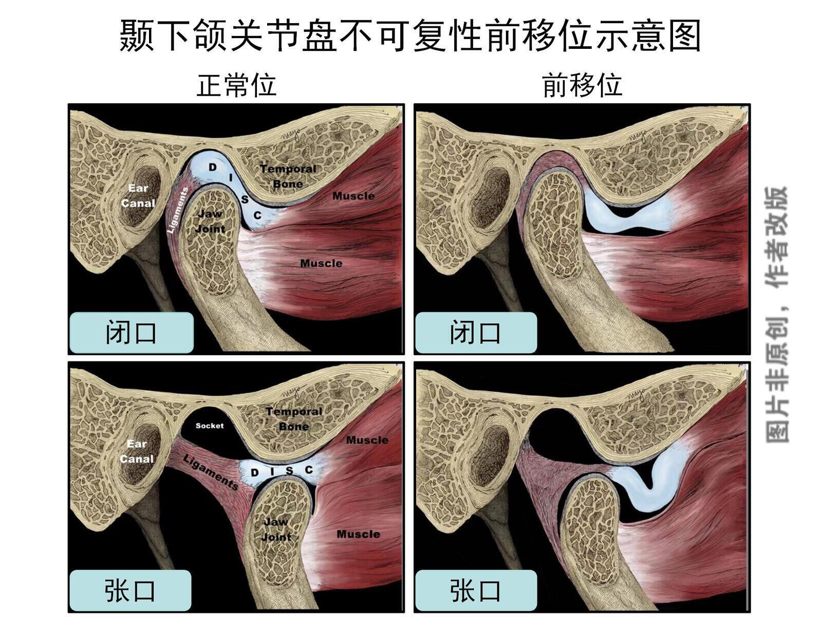 圖文圖片