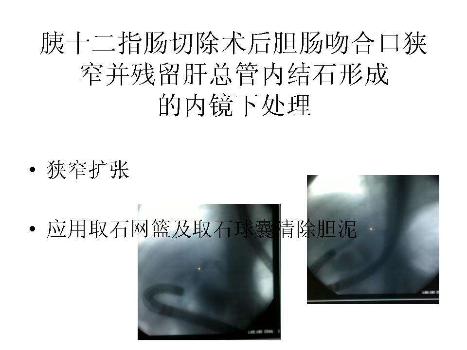 发表者:蔡开琳1790人已读