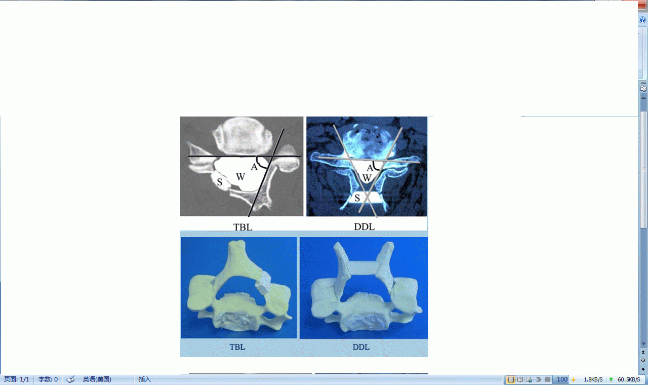 如何把握颈椎后路单开门与双开门的手术适应证?