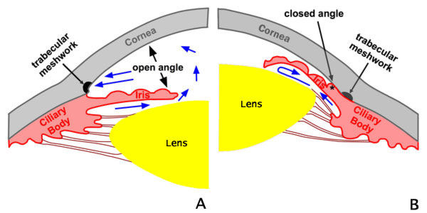 急性闭角型青光眼的发生机制