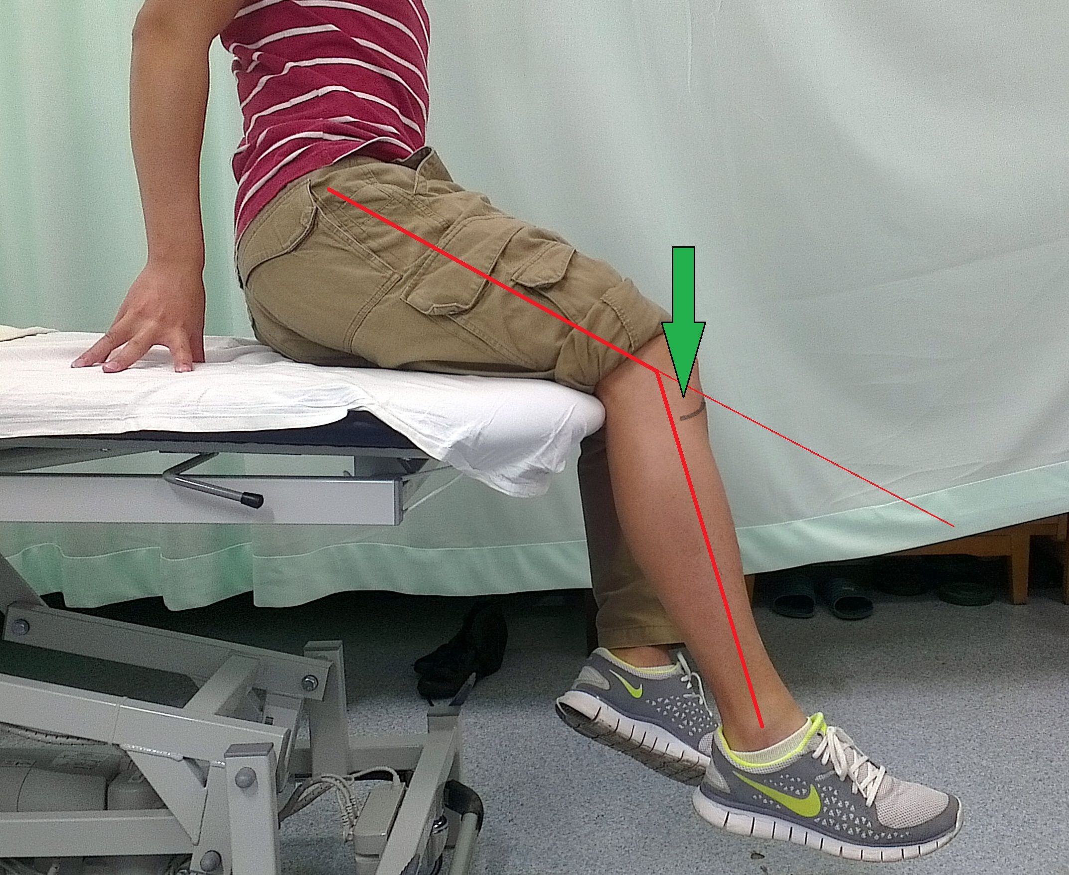 康复知识扫盲之:膝关节角度 - 好大夫在线