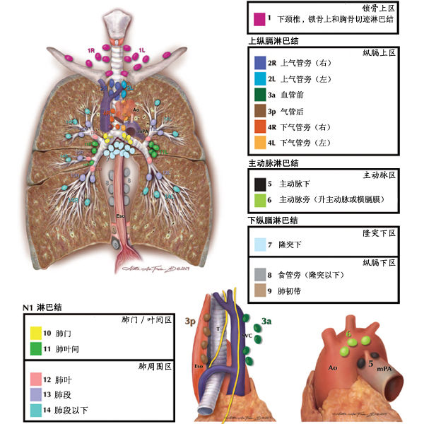 纵隔淋巴结分区图谱(美国胸科协会)