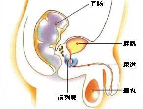 前列腺炎性增大時,可出現排尿無力,尿分叉,尿頻,尿不盡等;老年性前列