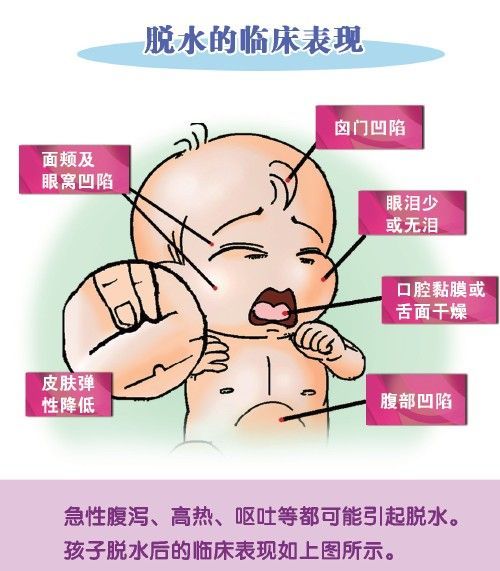 轮状病毒最大的危害——脱水 - 好大夫在线