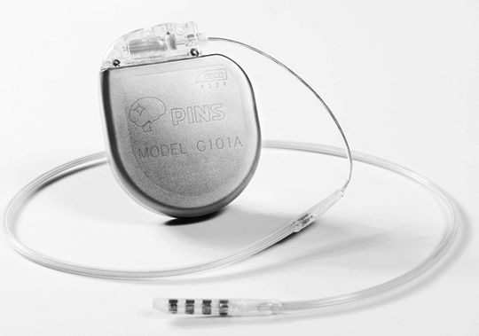 清华脑起搏器国产脑起搏器已在第四军医大学唐都医院应用